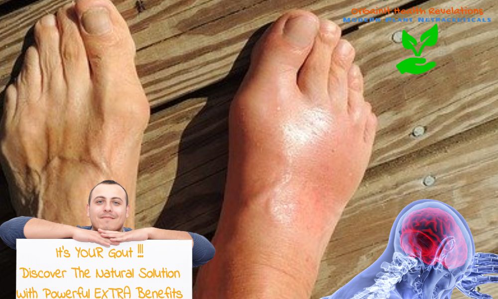 is turmeric curcumin good for gout? Yes Curcuminoids can cure gout