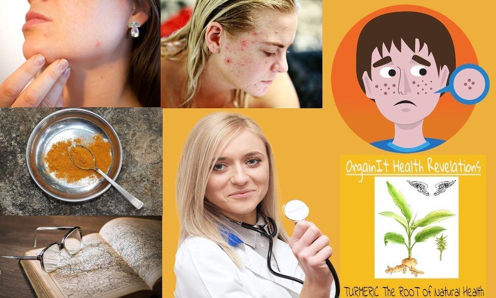 Summary of turmeric skin benefits from acne to anti-ageing